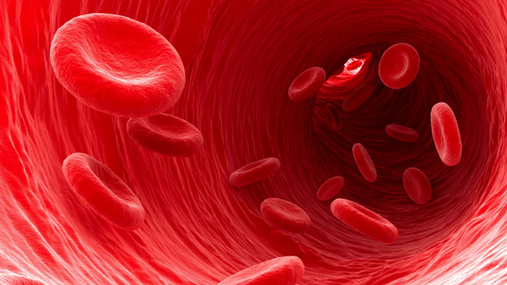 Anemia