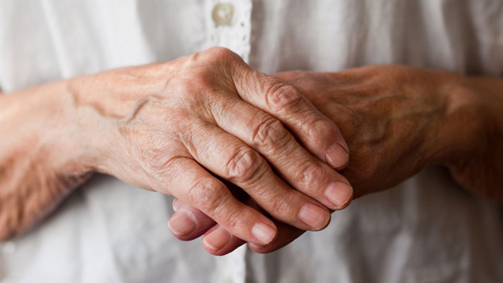 Arthritis