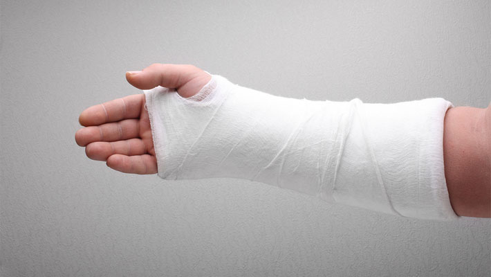 Cast