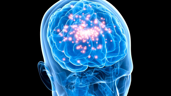 Epilepsy
