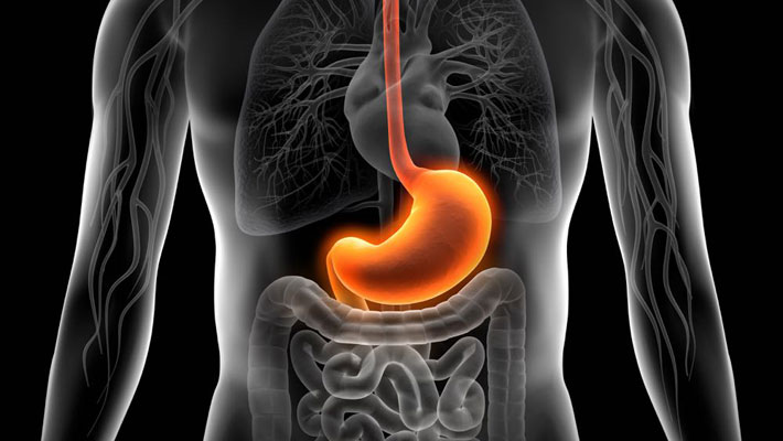Heartburn