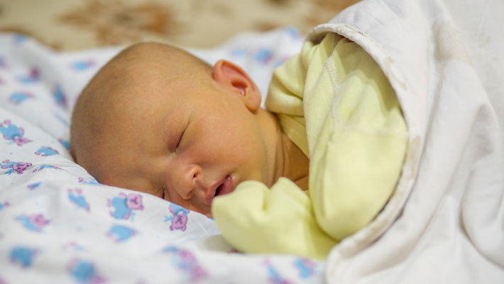 Jaundice In The Newborn