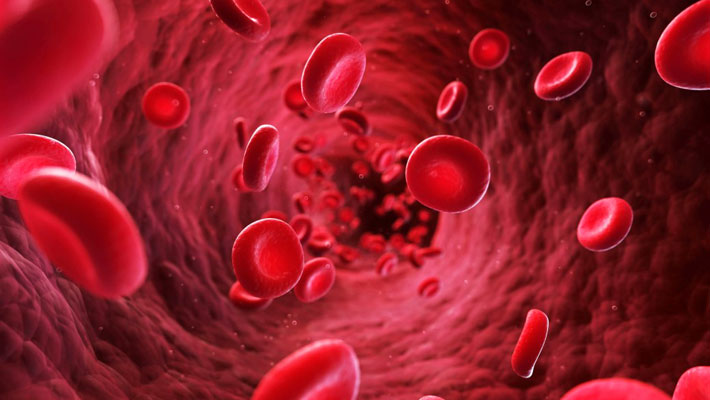 Thalassemia