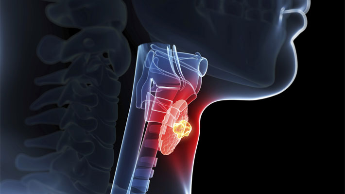 Thyroid